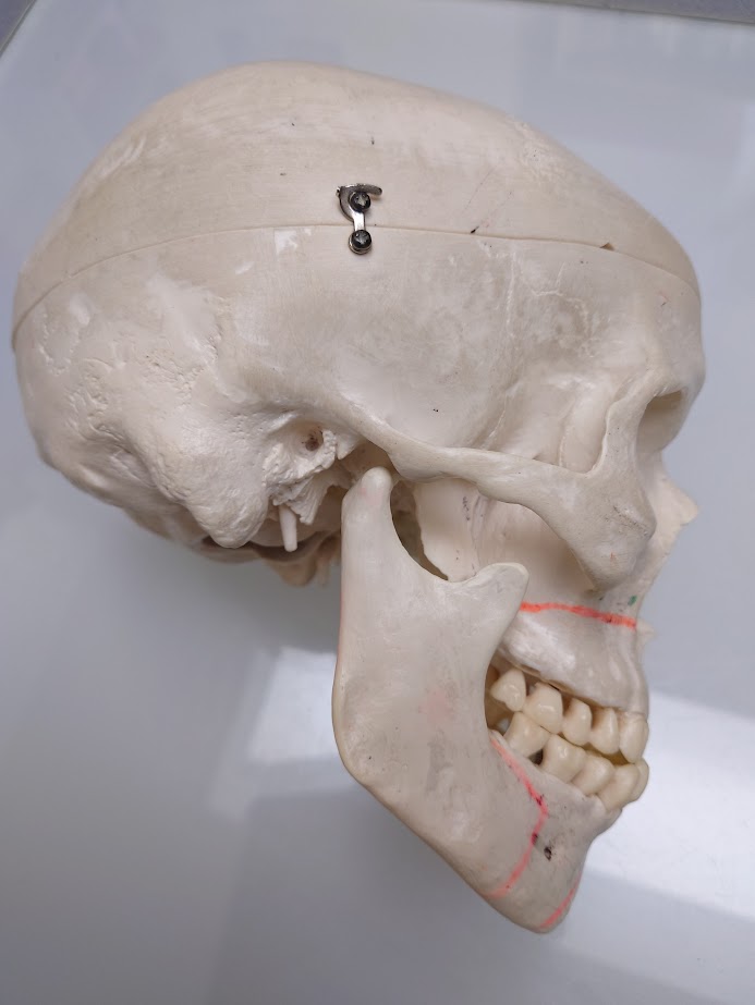 顎関節はMRI撮影が重要です!